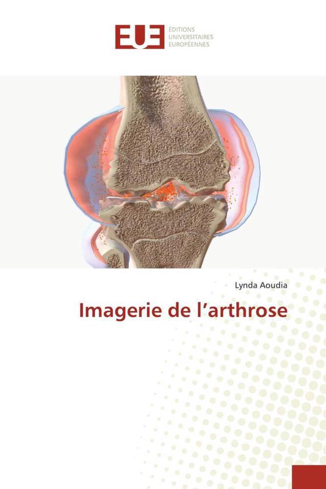 Imagerie de l'arthrose