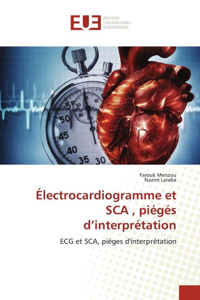 Électrocardiogramme et SCA , piégés d'interprétation