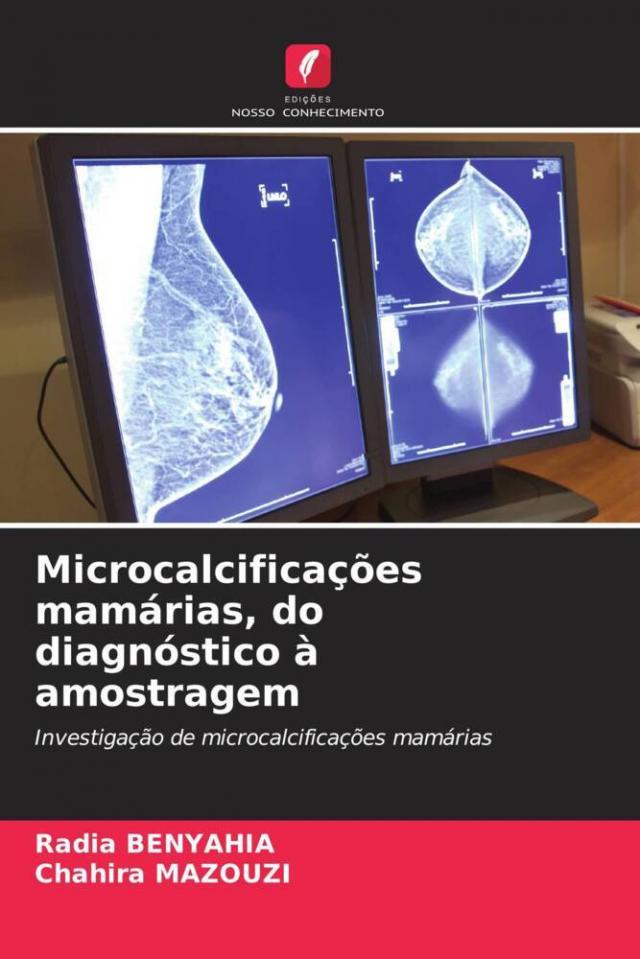 Microcalcificações mamárias, do diagnóstico à amostragem