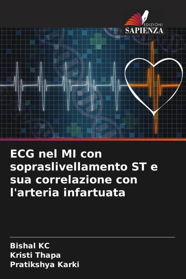 ECG nel MI con sopraslivellamento ST e sua correlazione con l'arteria infartuata