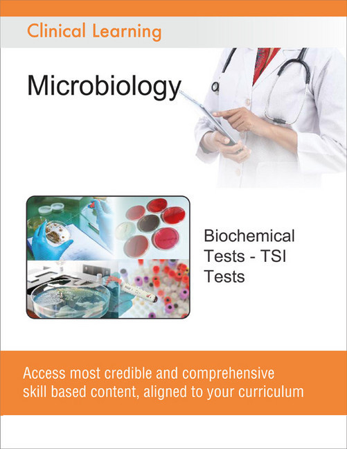 Biochemical Tests - TSI Tests