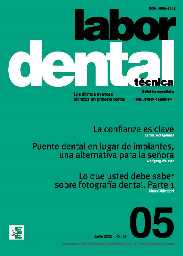 Labor Dental Técnica Nº5 Vol.25