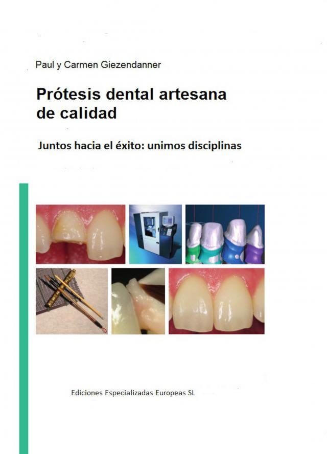 Prótesis dental artesanal de calidad