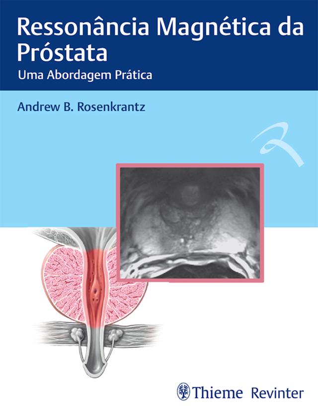 Ressonância Magnética da Próstata