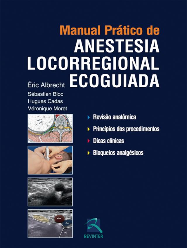Manual prático de anestesia locorregional ecoguiada