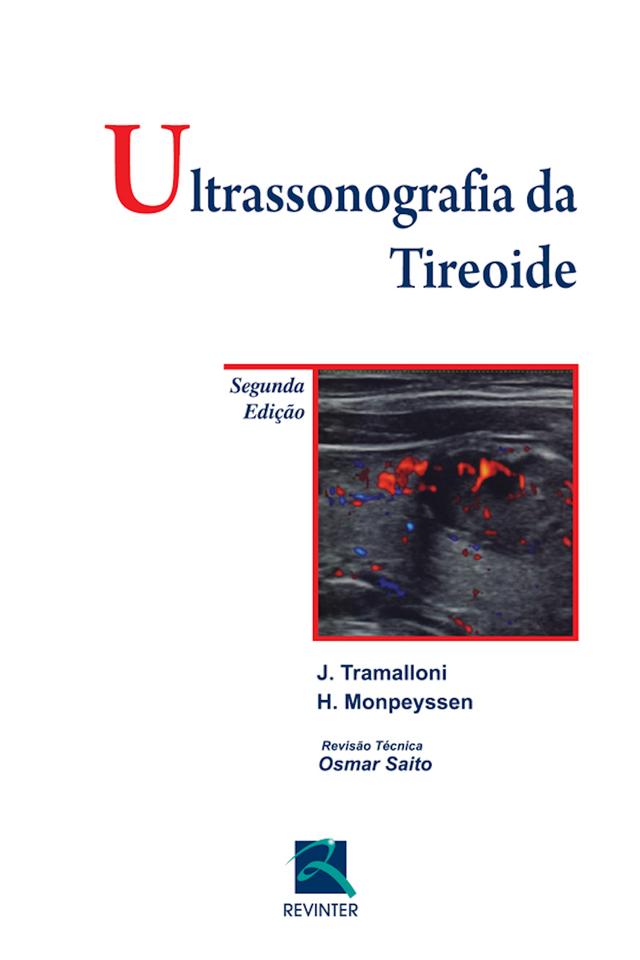 Ultrassonografia da tireoide