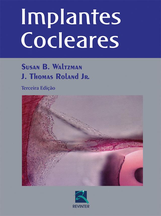 Implantes cocleares