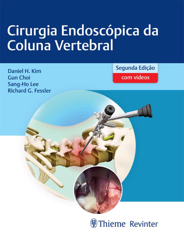 Cirurgia Endoscópica da Coluna Vertebral