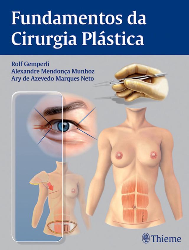 Fundamentos da cirurgia plástica