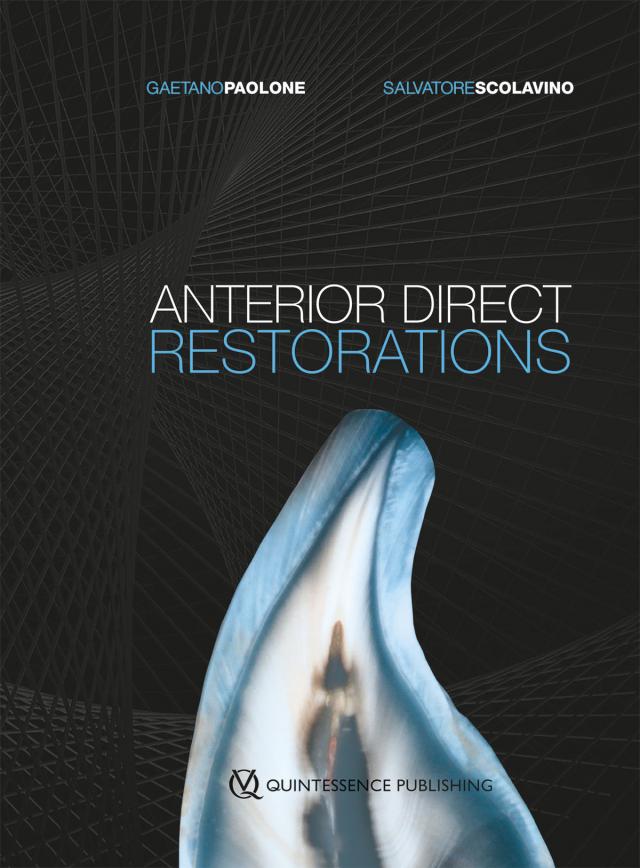 Anterior Direct Restorations