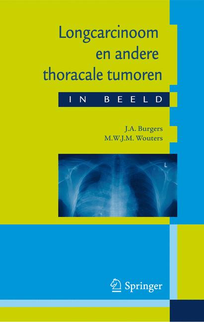 Longcarcinoom en andere thoracale tumoren in beeld
